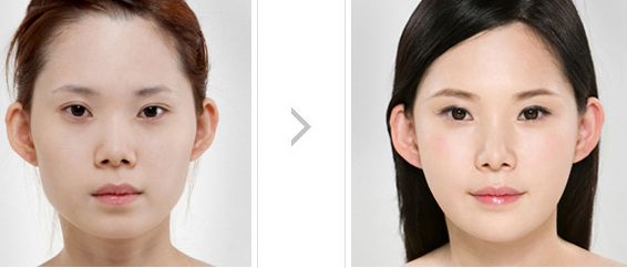 如何评价上海智美颜和医疗美容医院的双眼皮技术和价格？