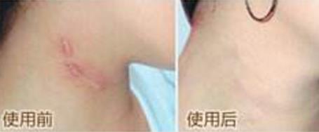 上海眼底纹去除排行榜：10家美容医院内幕揭秘！