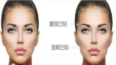 杭州专业整形磨骨医院推荐｜颠覆时光，打造完美脸型