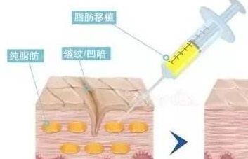 阳光、连天美、柠栎、芙洛拉，哪家是义乌整形医院独孤求败？【2023最新榜单揭秘】