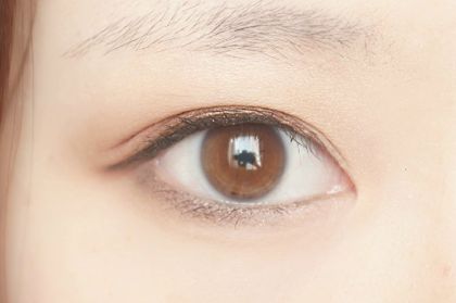 济宁有哪些靠谱的双眼皮手术医院值得推荐？