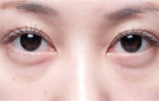 2023昆明双眼皮修复医生排行榜揭晓，前三面临巨大挑战，榜首竟然惊人！
