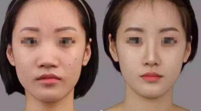 韩国皮肤管理医院TOP10推荐：祛斑、祛痘必去之地