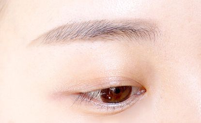 南京双眼皮哪家做的好？九大推荐医院解析，告诉你哪家医院的双眼皮手术最佳