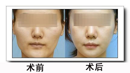 2023年郑州市鼻整形外科医疗美容医院口碑盛誉，放眼十强名单准确推荐！