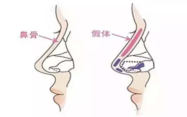 昆明细纹剥离术推荐医院排行【最新更新】