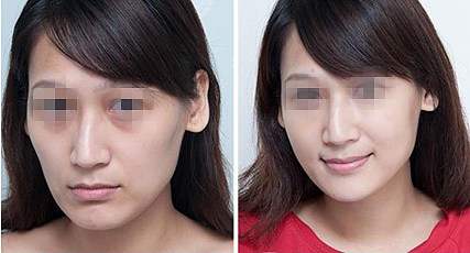 2023年广州美贝尔修复双眼皮正规美容医院TOP10名单盘点，这些医院备受瞩目！