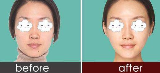 宁波薇琳医疗美容医院眼部修复和吸脂效果如何？