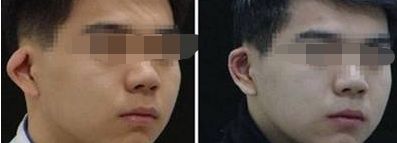 北京儿童医院眼科就诊指南：电话、价格表、在线挂号及半飞秒手术详情