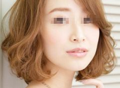 长沙亚韩医疗美容眼袋治疗攻略，专家推荐与你分享