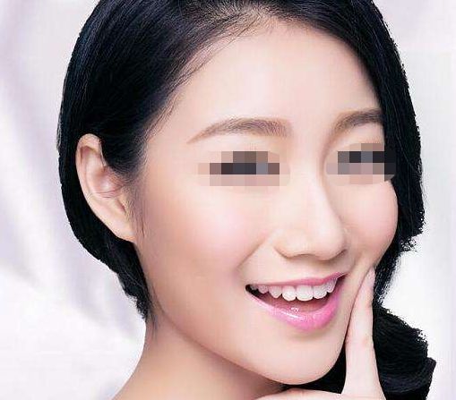 巴诺巴奇韩国下颌角手术：开启V脸焕颜蜕变之旅