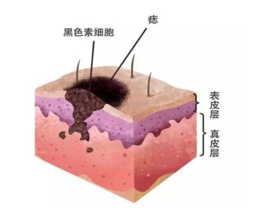 2023厦门中西医结合去痘前10强医生排行榜专业测评！邵玉秋、陈昱瑞、许春鹏医生大咖口碑推荐