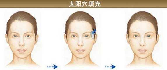 郑州哪些医生在假体隆胸技术上备受赞誉？点击查看！