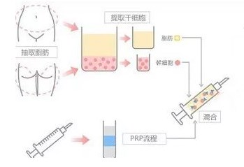 成都整容医生综合评测排名，李信奎、叶斌、靳小雷等备受好评！